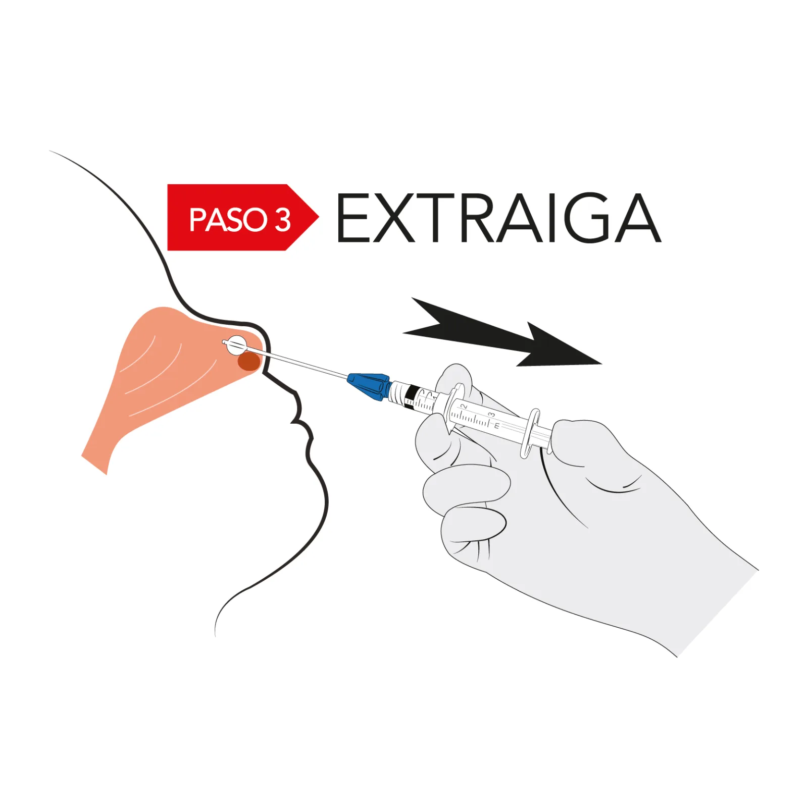 Katz Extractor®